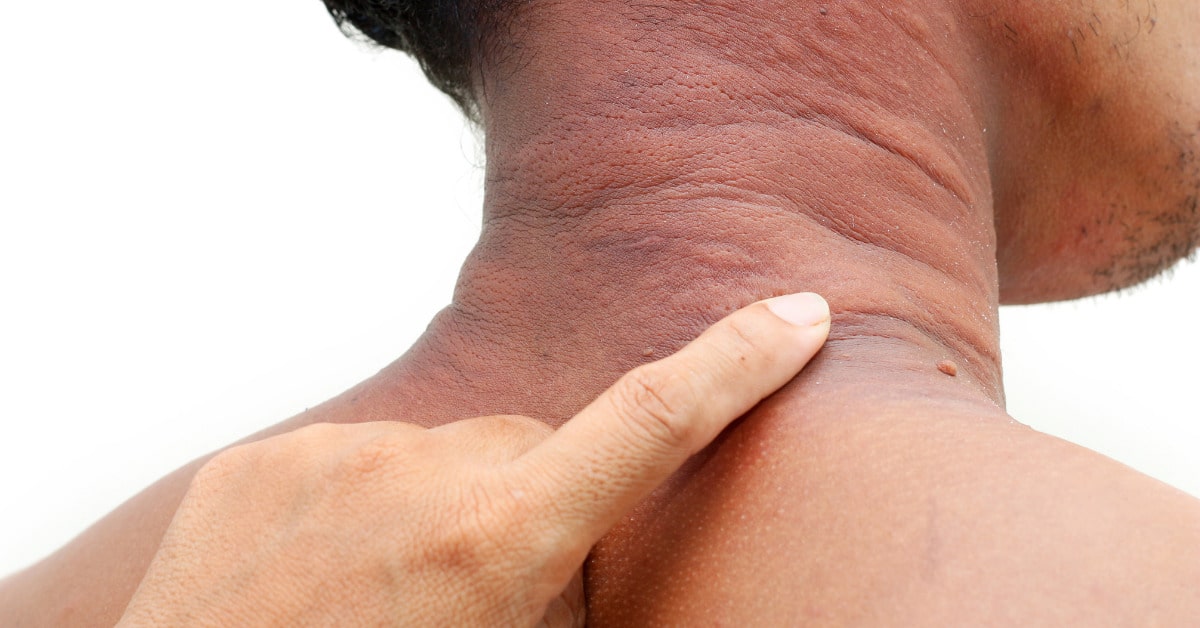 Qizlar dan penetrasyon dan konta